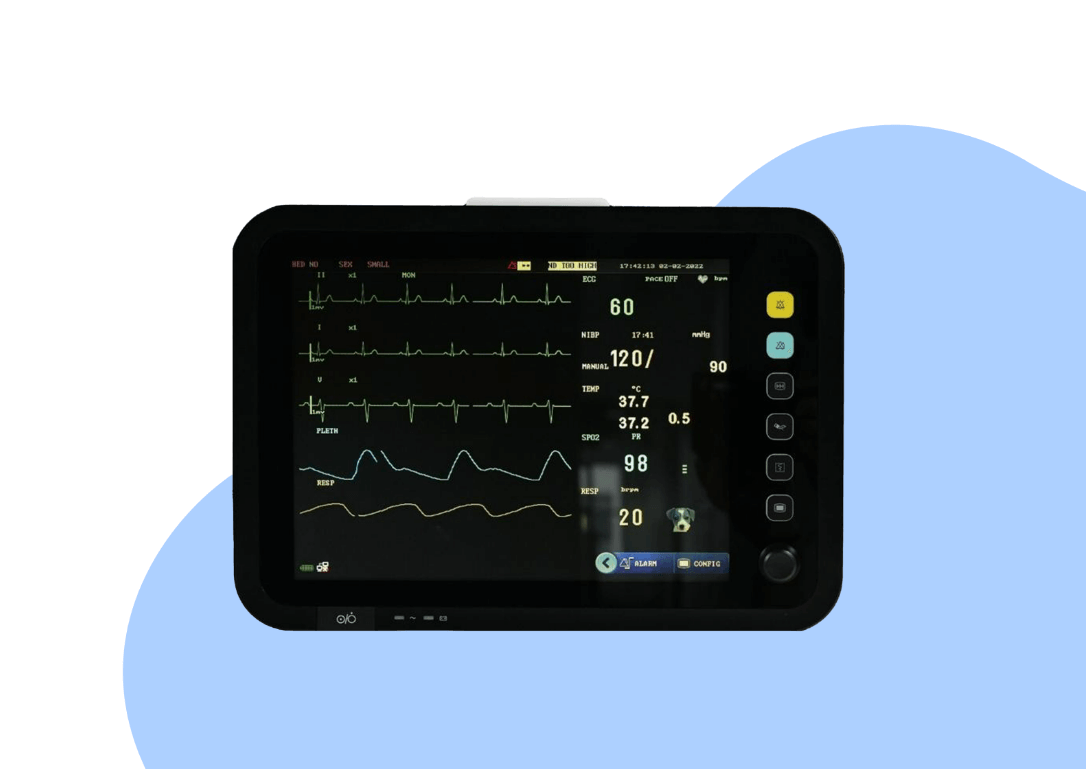 Le moniteur d’anesthésie