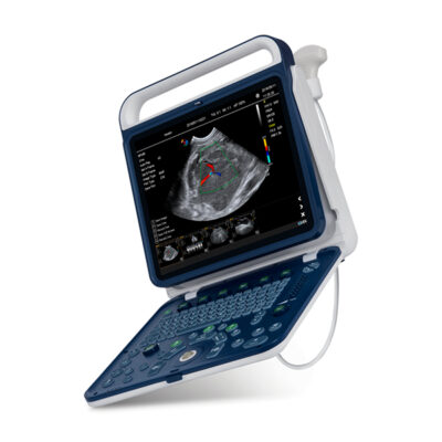 Echographe VPS60 Doppler Couleur